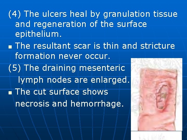 (4) The ulcers heal by granulation tissue and regeneration of the surface epithelium. n