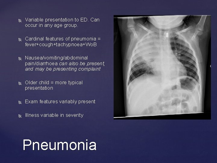  Variable presentation to ED. Can occur in any age group. Cardinal features of