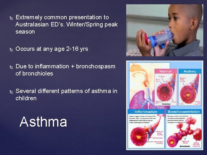  Extremely common presentation to Australasian ED’s. Winter/Spring peak season Occurs at any age