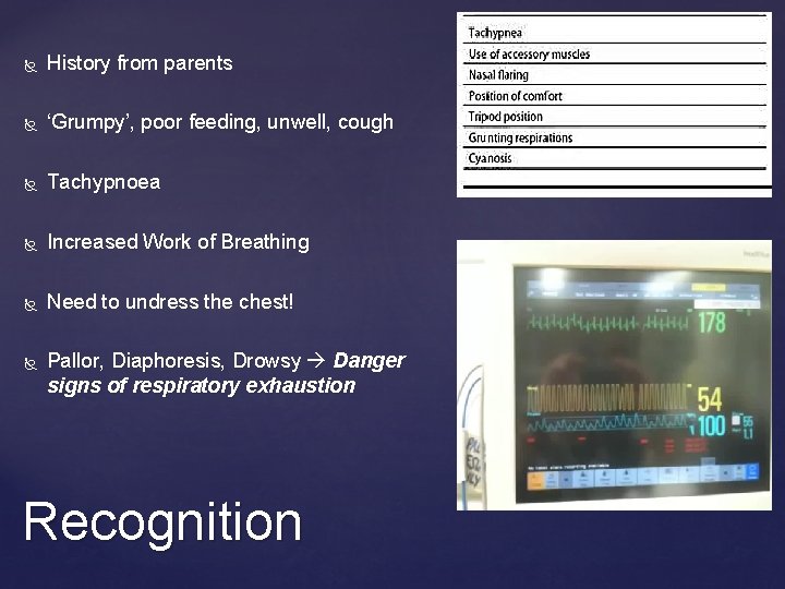  History from parents ‘Grumpy’, poor feeding, unwell, cough Tachypnoea Increased Work of Breathing