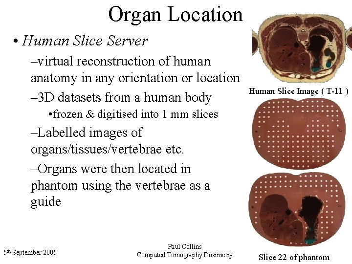 Organ Location • Human Slice Server –virtual reconstruction of human anatomy in any orientation