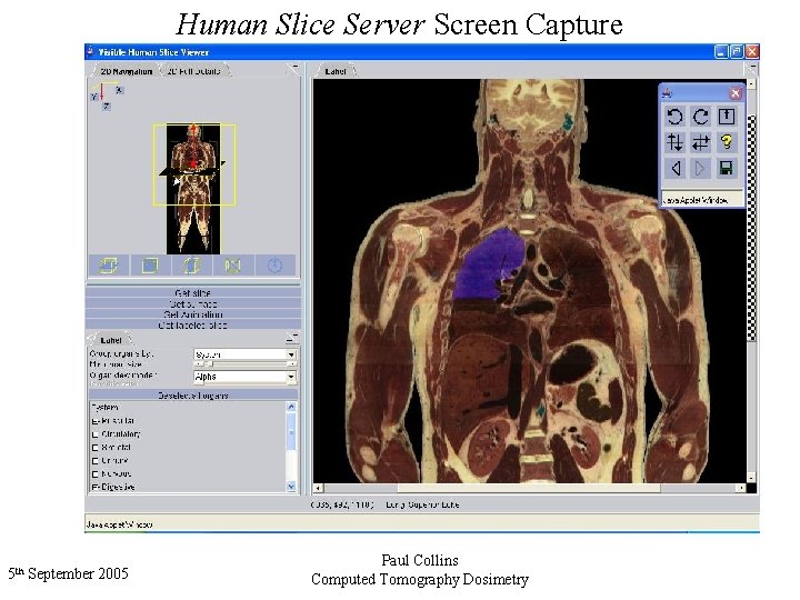 Human Slice Server Screen Capture 5 th September 2005 Paul Collins Computed Tomography Dosimetry