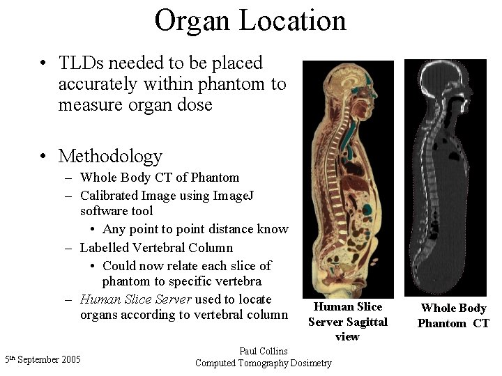 Organ Location • TLDs needed to be placed accurately within phantom to measure organ