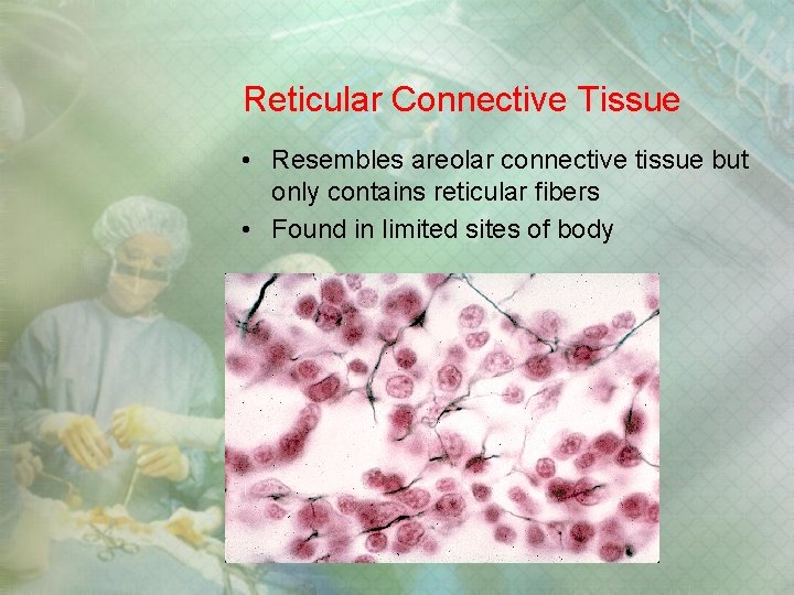 Reticular Connective Tissue • Resembles areolar connective tissue but only contains reticular fibers • Reticular Connective Tissue • Resembles areolar connective tissue but only contains reticular fibers •