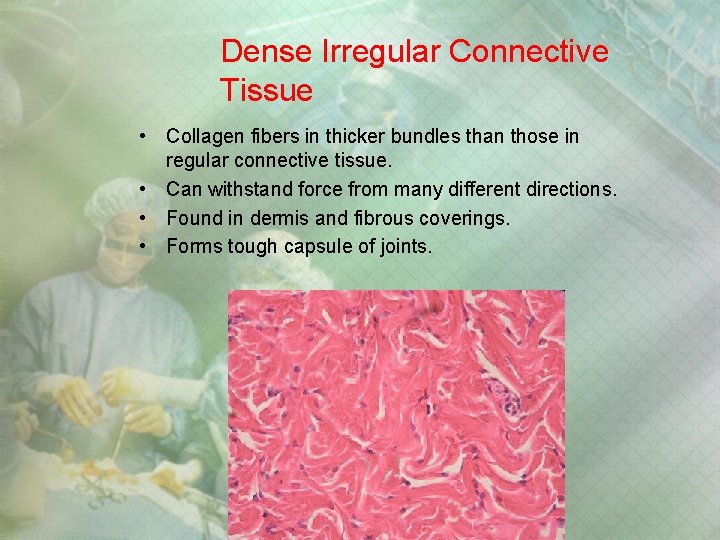 Dense Irregular Connective Tissue • Collagen fibers in thicker bundles than those in regular Dense Irregular Connective Tissue • Collagen fibers in thicker bundles than those in regular