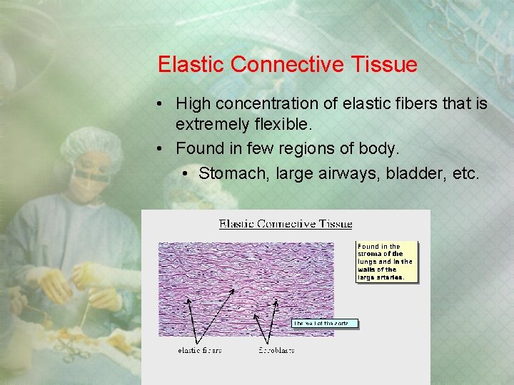 Elastic Connective Tissue • High concentration of elastic fibers that is extremely flexible. • Elastic Connective Tissue • High concentration of elastic fibers that is extremely flexible. •