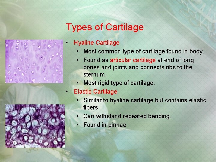 Types of Cartilage • Hyaline Cartilage • Most common type of cartilage found in Types of Cartilage • Hyaline Cartilage • Most common type of cartilage found in