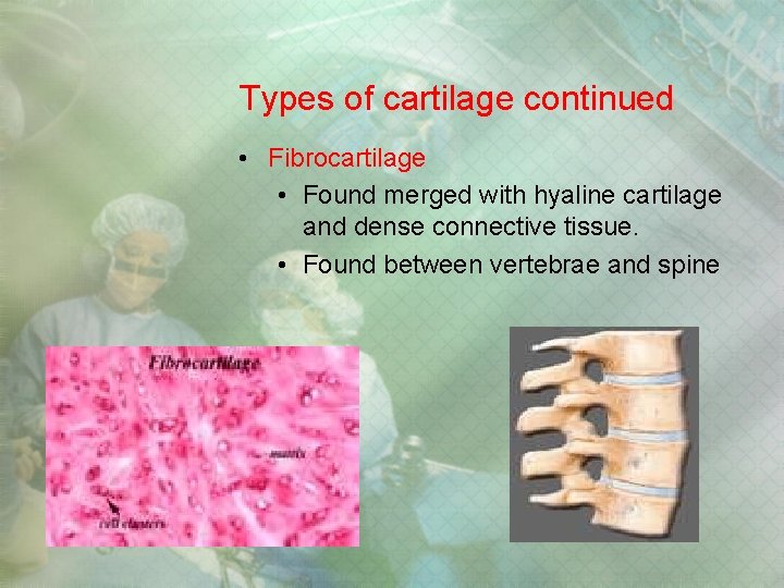 Types of cartilage continued • Fibrocartilage • Found merged with hyaline cartilage and dense Types of cartilage continued • Fibrocartilage • Found merged with hyaline cartilage and dense