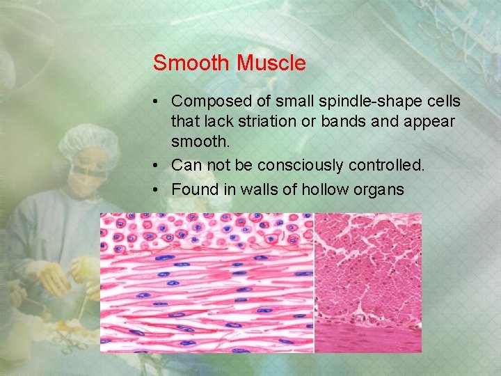 Smooth Muscle • Composed of small spindle-shape cells that lack striation or bands and Smooth Muscle • Composed of small spindle-shape cells that lack striation or bands and
