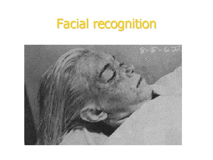 Facial recognition 