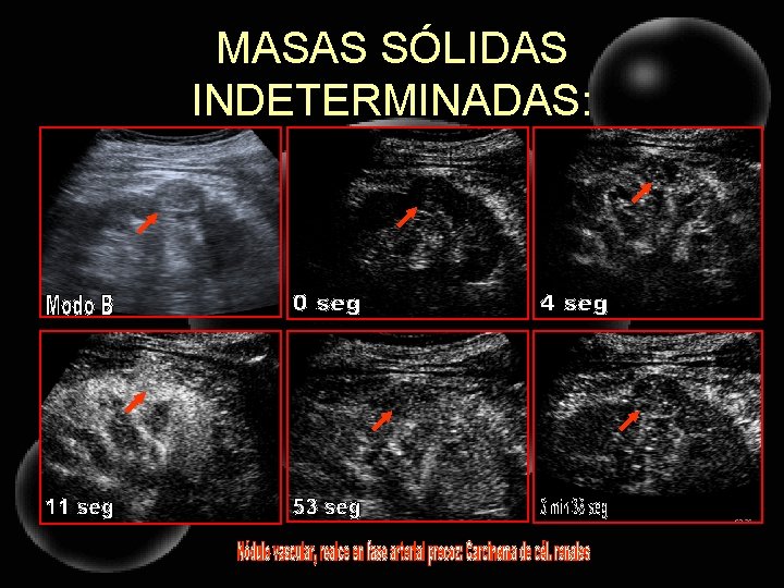 MASAS SÓLIDAS INDETERMINADAS: 