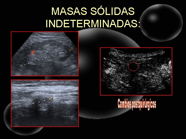 MASAS SÓLIDAS INDETERMINADAS: 
