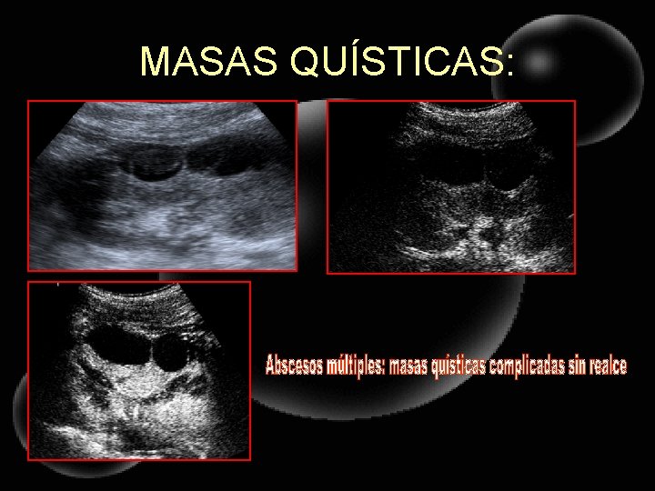MASAS QUÍSTICAS: 
