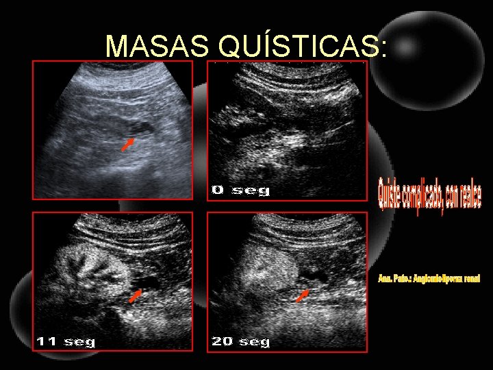 MASAS QUÍSTICAS: 