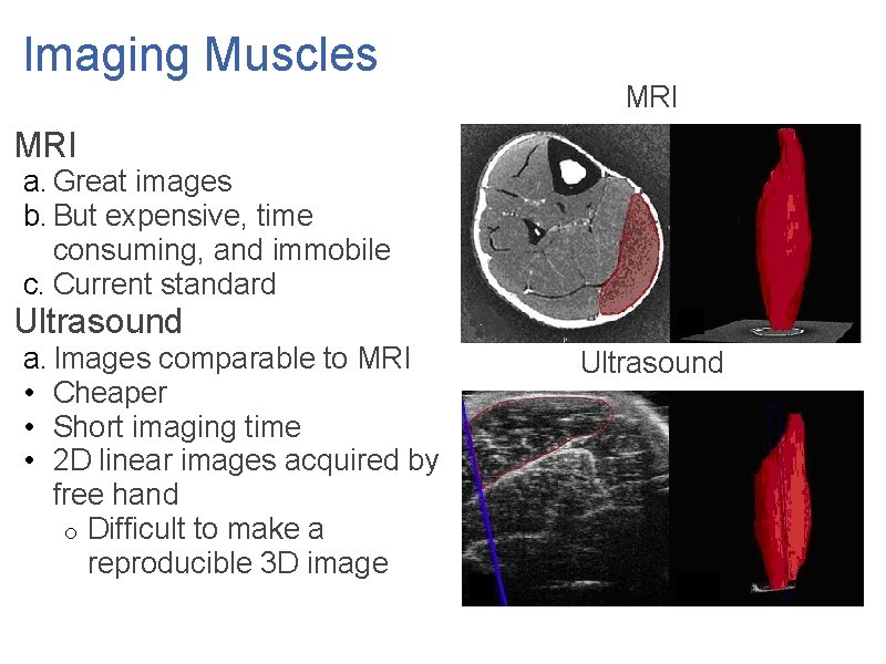 Imaging Muscles MRI a. Great images b. But expensive, time consuming, and immobile c.