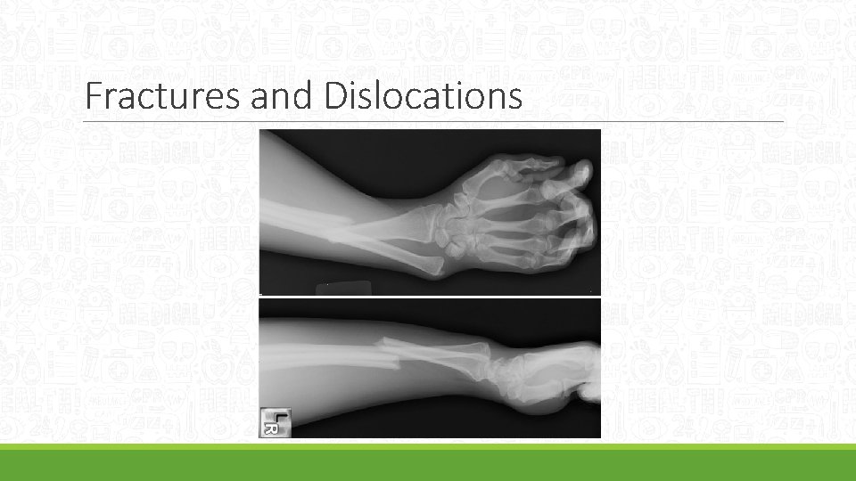 Fractures and Dislocations 