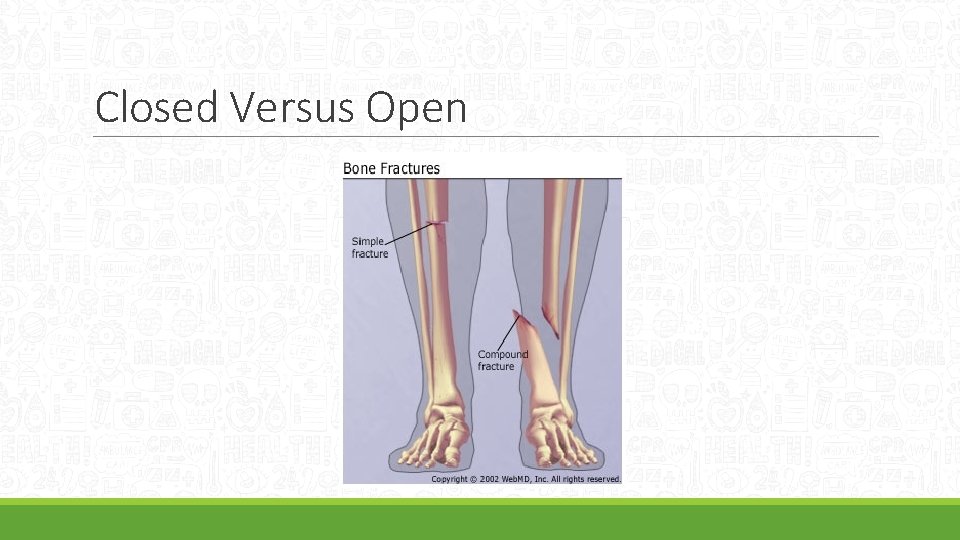 Closed Versus Open 