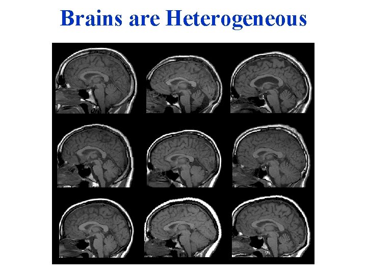 Brains are Heterogeneous Slide from Duke course 