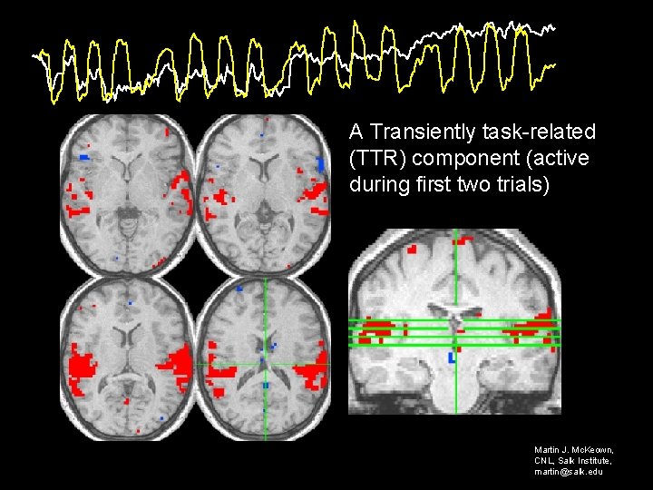 A Transiently task-related (TTR) component (active during first two trials) Martin J. Mc. Keown,