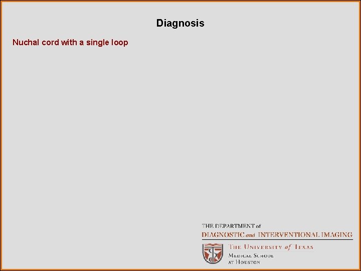 Diagnosis Nuchal cord with a single loop 