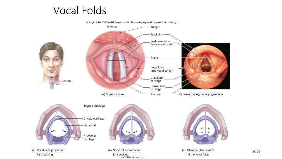 Vocal Folds 23 -21 