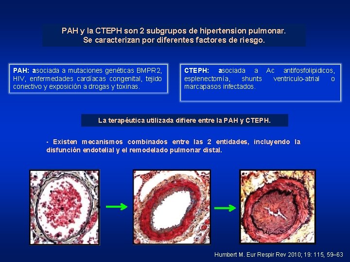 PAH y la CTEPH son 2 subgrupos de hipertension pulmonar. Se caracterizan por diferentes