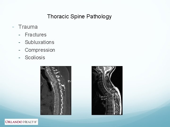 Thoracic Spine Pathology - Trauma - Fractures Subluxations Compression Scoliosis 