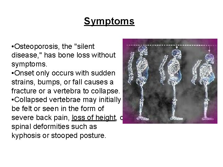 Symptoms • Osteoporosis, the "silent disease, " has bone loss without symptoms. • Onset