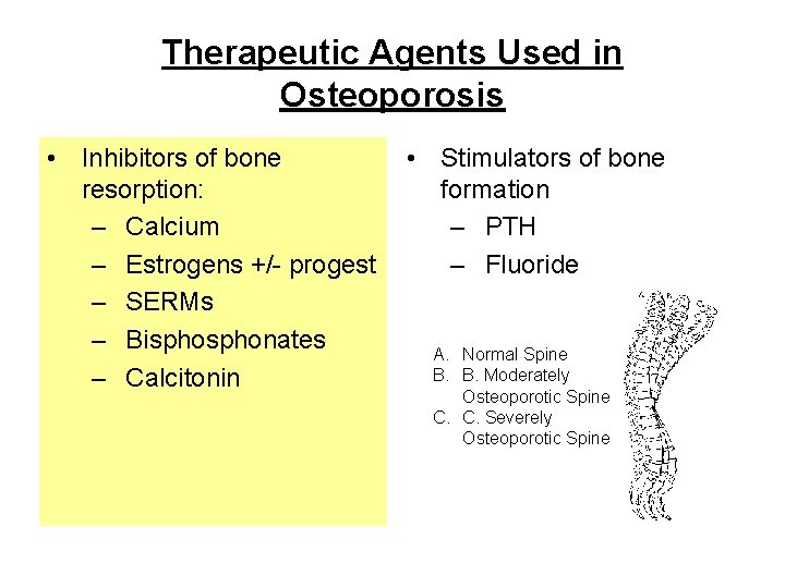 Therapeutic Agents Used in Osteoporosis • Inhibitors of bone resorption: – Calcium – Estrogens