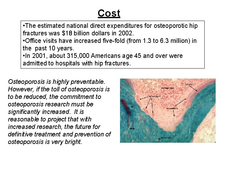Cost • The estimated national direct expenditures for osteoporotic hip fractures was $18 billion