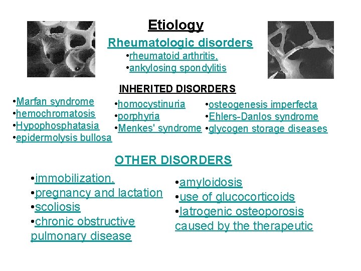 Etiology Rheumatologic disorders • rheumatoid arthritis, • ankylosing spondylitis • Marfan syndrome • hemochromatosis