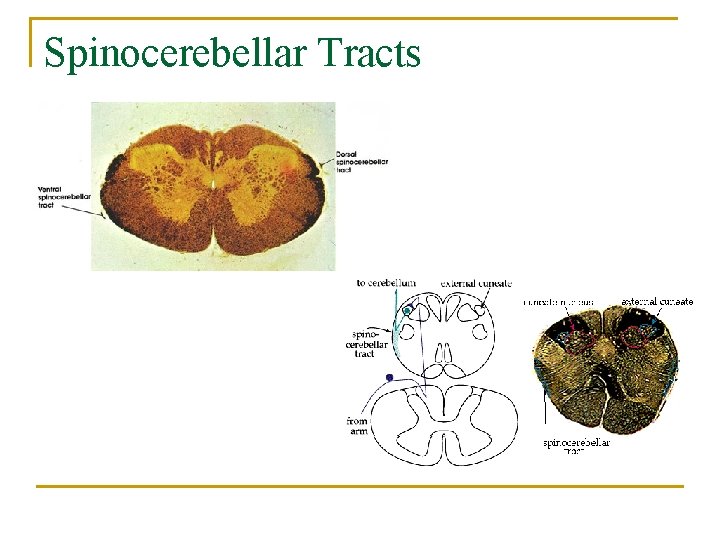 Spinocerebellar Tracts 
