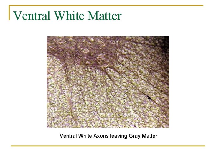 Ventral White Matter Ventral White Axons leaving Gray Matter 