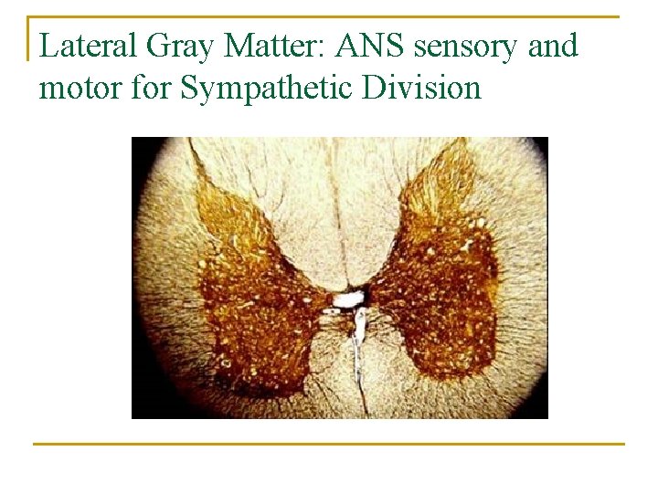 Lateral Gray Matter: ANS sensory and motor for Sympathetic Division 