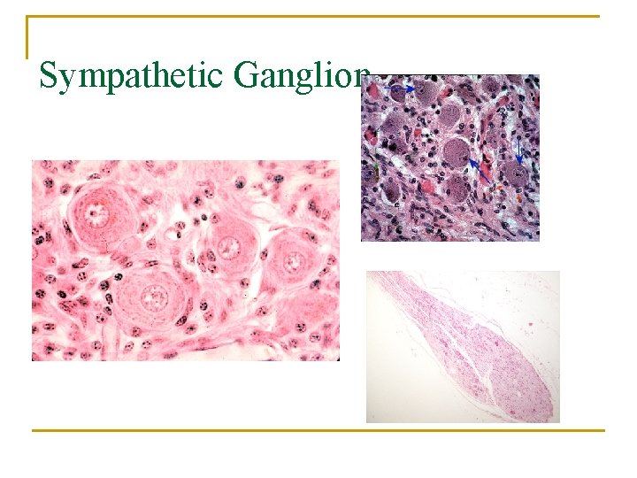 Sympathetic Ganglion 
