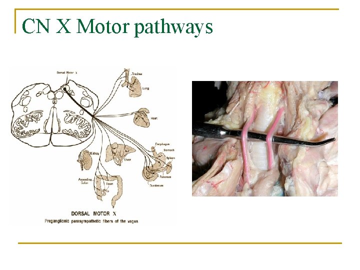 CN X Motor pathways 