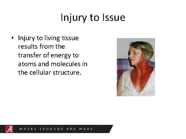 Injury to Issue • Injury to living tissue results from the transfer of energy