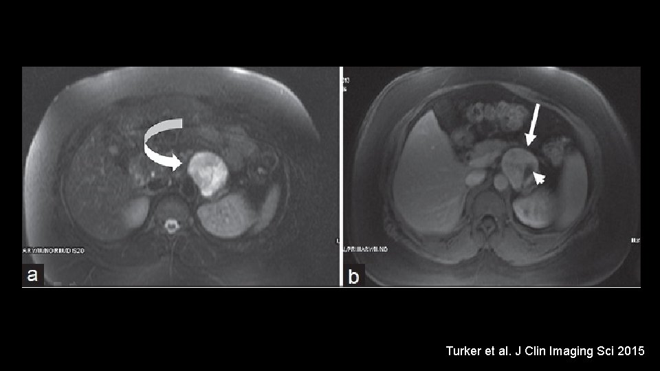 Turker et al. J Clin Imaging Sci 2015 Turker et al. J Clin Imaging Sci 2015