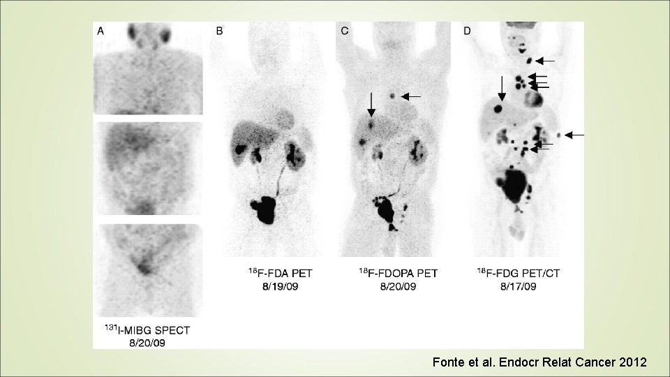 Fonte et al. Endocr Relat Cancer 2012 Fonte et al. Endocr Relat Cancer 2012