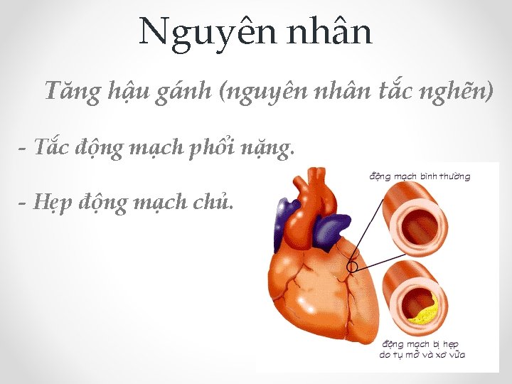 Nguyên nhân Tăng hậu gánh (nguyên nhân tắc nghẽn) - Tắc động mạch phổi