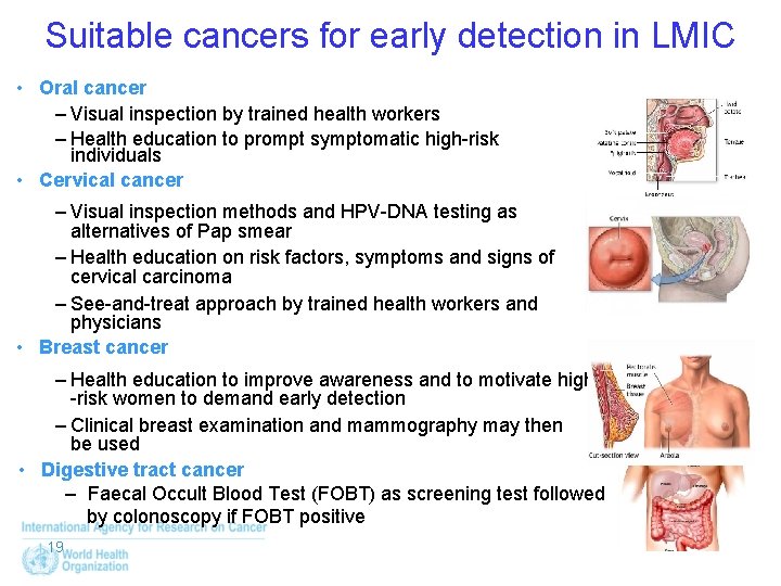 Suitable cancers for early detection in LMIC • Oral cancer – Visual inspection by