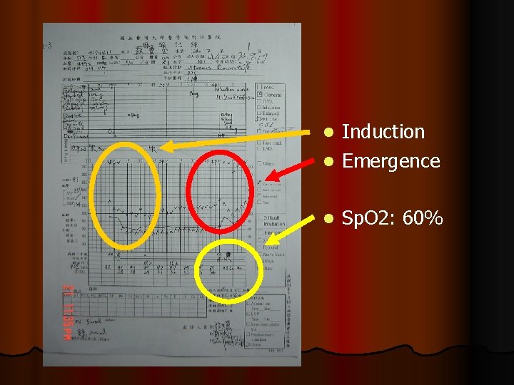 Induction l Emergence l l Sp. O 2: 60% 