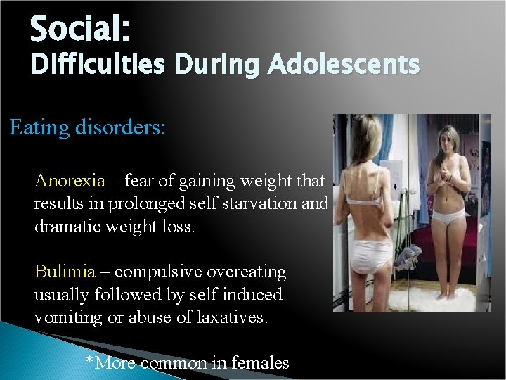 Social: Difficulties During Adolescents Eating disorders: Anorexia – fear of gaining weight that results