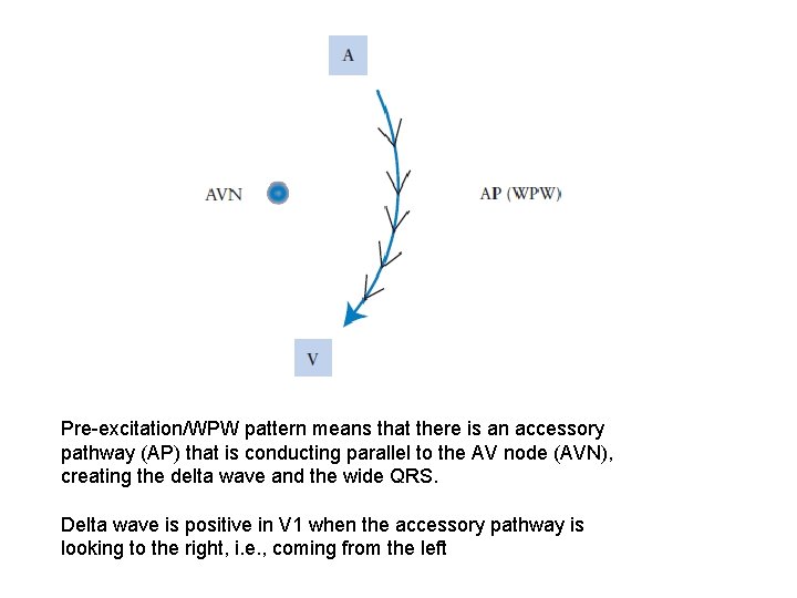 Pre-excitation/WPW pattern means that there is an accessory pathway (AP) that is conducting parallel