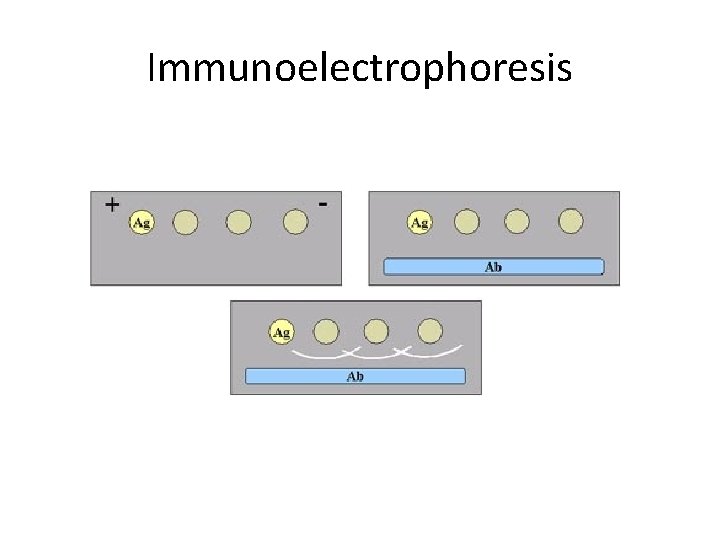 Immunoelectrophoresis 