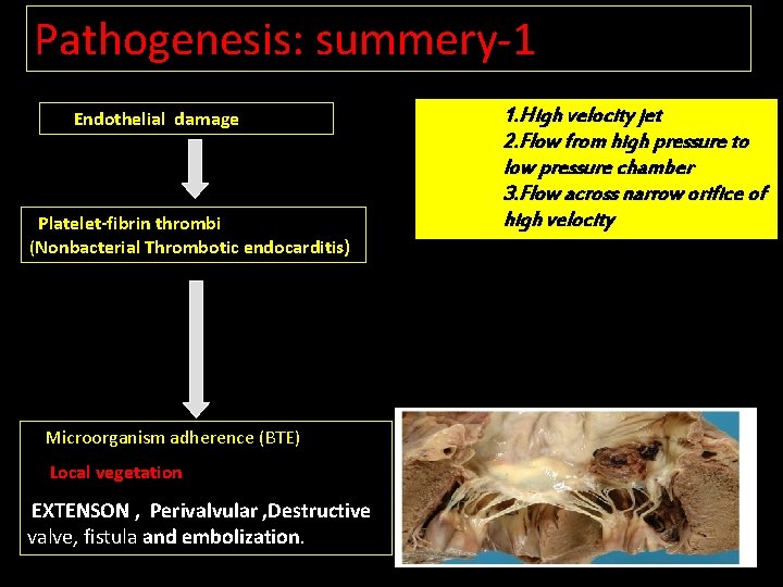 Pathogenesis: summery-1 Endothelial damage Platelet-fibrin thrombi (Nonbacterial Thrombotic endocarditis) Microorganism adherence (BTE) Local vegetation