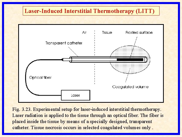 MEDICAL LASER SYSTEMS Assist Prof Dr Lutfi Ghulam