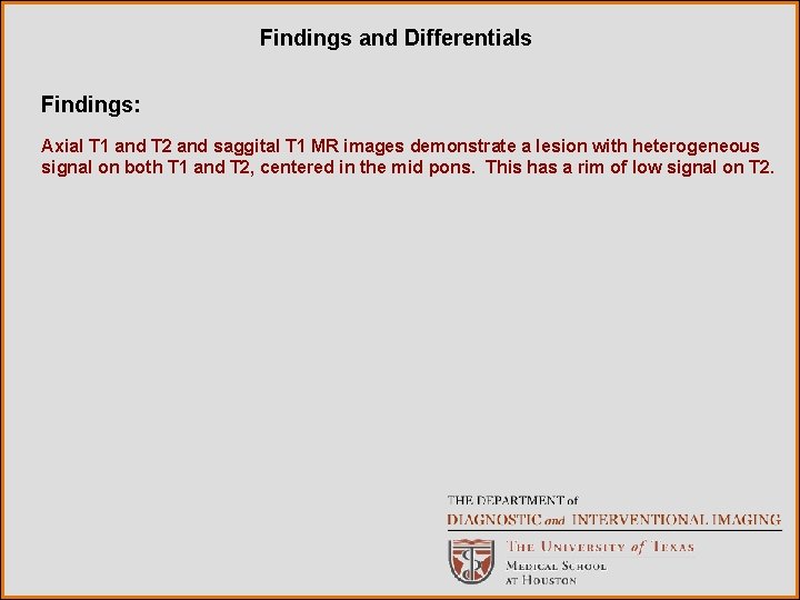 Findings and Differentials Findings: Axial T 1 and T 2 and saggital T 1