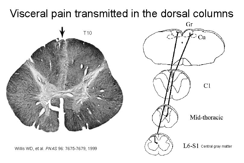 Visceral pain transmitted in the dorsal columns T 10 Willis WD, et al. PNAS