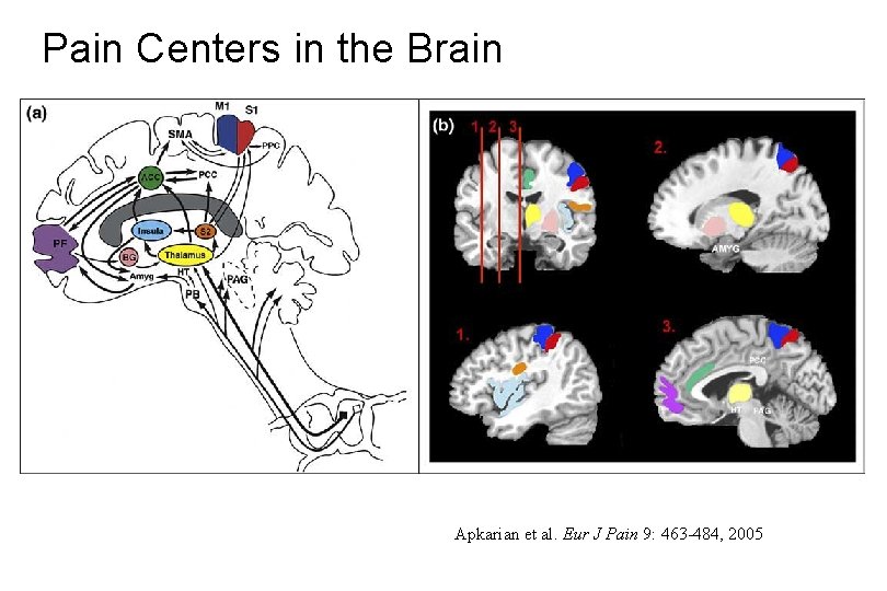 Pain Centers in the Brain Apkarian et al. Eur J Pain 9: 463 -484,